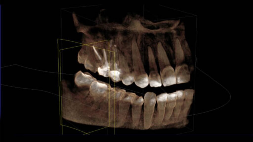 rontgen CBCT 3D Cirebon