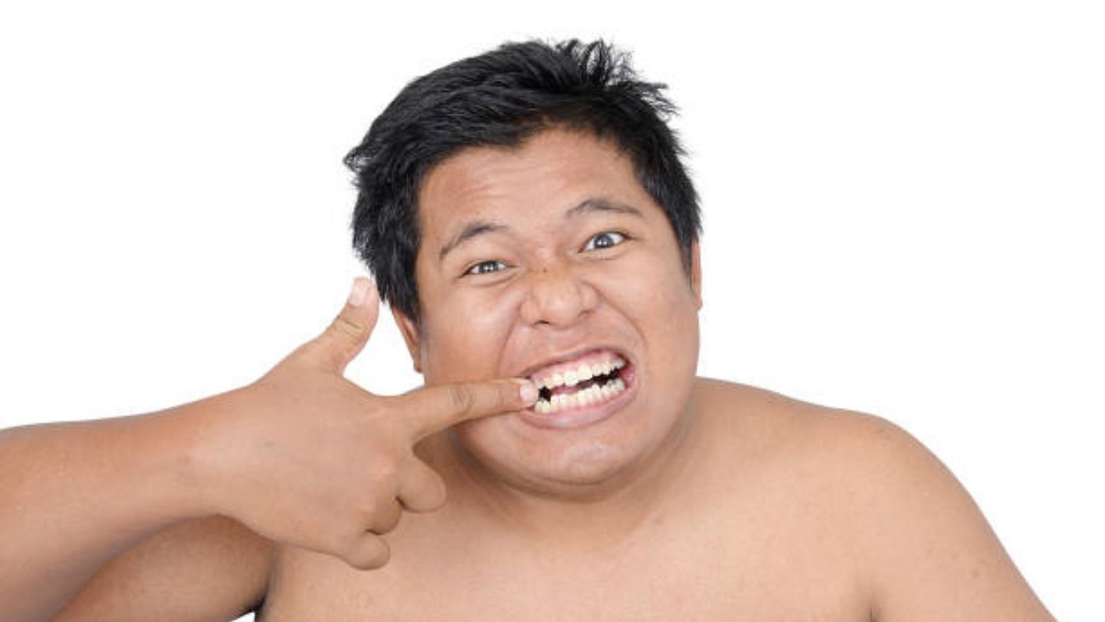 Gigi Bolong Tumbuh Daging: Apa Penyebab dan Cara Mengatasinya?