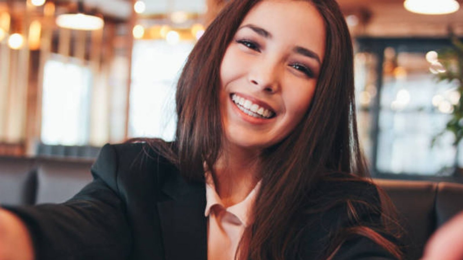 Kenapa Gigi Hitam? Ini Penyebab, Cara Mengatasi, dan Tips Mencegahnya