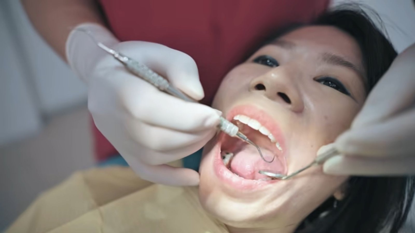 Perbedaan Tambal Gigi BPJS dan Umum: Mana yang Lebih Cocok untuk Anda?