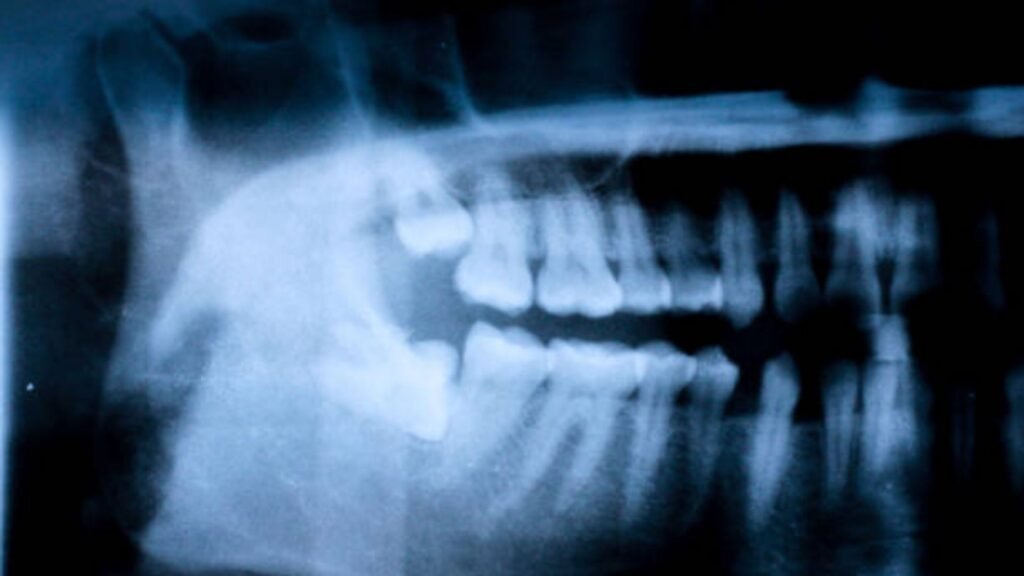X Ray Gigi
